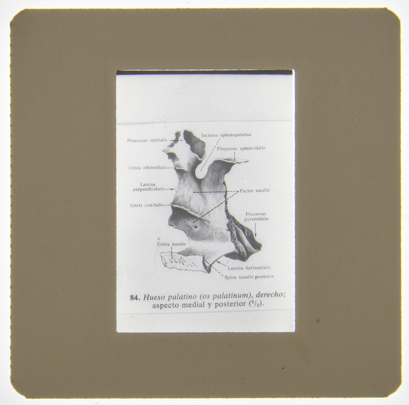 Diagrama anatómico científico que ilustra la sexta vértebra cervical (C6) desde una perspectiva superior. La imagen detalla las partes constitutivas del hueso, como el cuerpo vertebral, el proceso espinoso y los forámenes, utilizando terminología técnica en español y latín. Es un recurso gráfico destinado al estudio académico de la osteología humana.