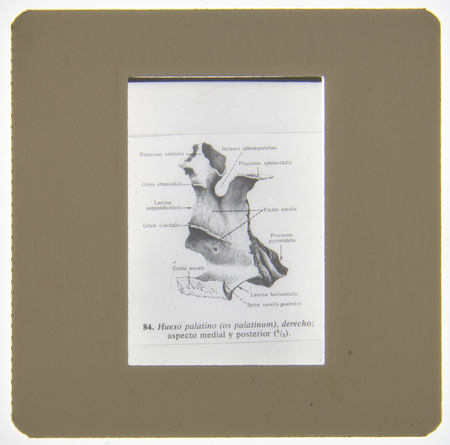 Diagrama anatómico científico que ilustra la sexta vértebra cervical (C6) desde una perspectiva superior. La imagen detalla las partes constitutivas del hueso, como el cuerpo vertebral, el proceso espinoso y los forámenes, utilizando terminología técnica en español y latín. Es un recurso gráfico destinado al estudio académico de la osteología humana.